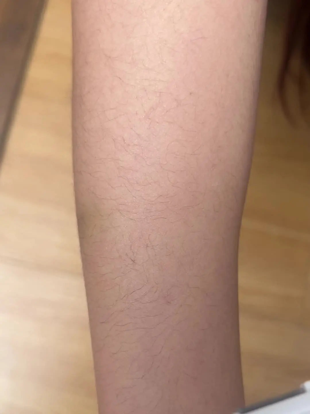 4in 1 Women's Electric Hair Remover/Women's Multi-Function Electric Hair Remover Set/Women's Bikini Trimmer/USB Rechargeable/Hair Remover for Eyebrows, Nose, Face, Legs, / Portable, Gentle, Women's Gift, Mother's Day Gift MedSurgery Store For Digital Health