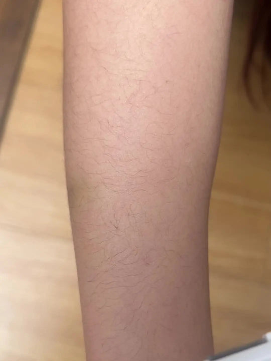 4in 1 Women's Electric Hair Remover/Women's Multi-Function Electric Hair Remover Set/Women's Bikini Trimmer/USB Rechargeable/Hair Remover for Eyebrows, Nose, Face, Legs, / Portable, Gentle, Women's Gift, Mother's Day Gift MedSurgery Store For Digital Health