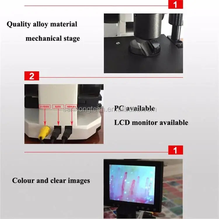 Equipo analizador de microcirculación y microscopio para diagnosticar enfermedades de pronóstico máquina de cuidado de la salud temprana MedSurgery Store For Digital Health