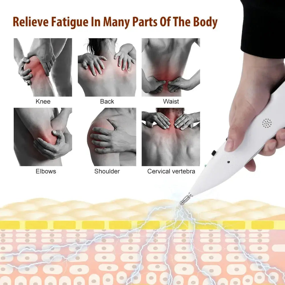 Pluma de acupuntura médica, Detector de puntos, masaje corporal electrónico, terapia del dolor, alivio eléctrico del dolor, cuidado de la salud, dispositivo de uso doméstico MedSurgery Store For Digital Health