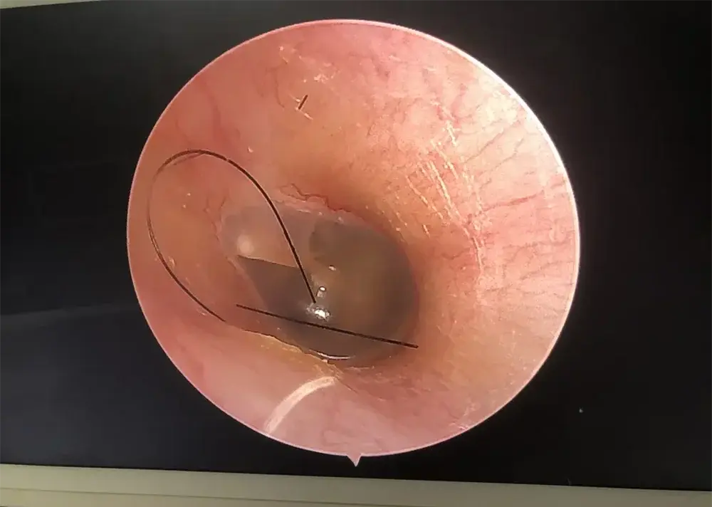 Unidad de endoscopio digital médico Full HD, sistema de vídeo de endoscopia con cabezal de cámara FHD, 1080P MedSurgery Store For Digital Health