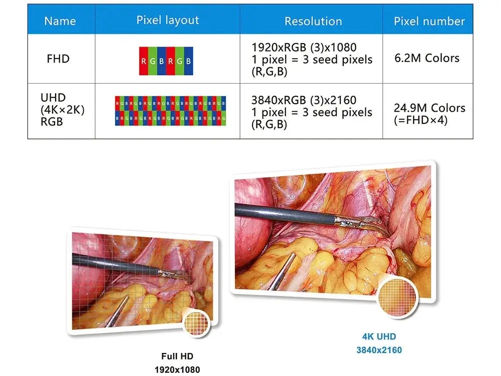 Equipo de cirugía médica Sistema de imagen endoscópica Uhd 4k MedSurgery Store For Digital Health