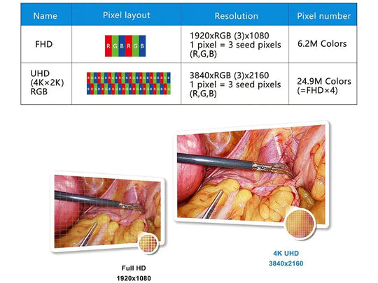 Equipo de cirugía médica Sistema de imagen endoscópica Uhd 4k MedSurgery Store For Digital Health