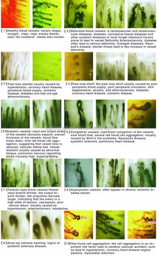 Equipo analizador de microcirculación y microscopio para diagnosticar enfermedades de pronóstico máquina de cuidado de la salud temprana MedSurgery Store For Digital Health