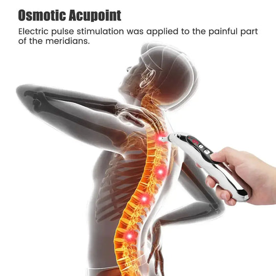 Pluma de acupuntura médica, Detector de puntos, masaje corporal electrónico, terapia del dolor, alivio eléctrico del dolor, cuidado de la salud, dispositivo de uso doméstico MedSurgery Store For Digital Health